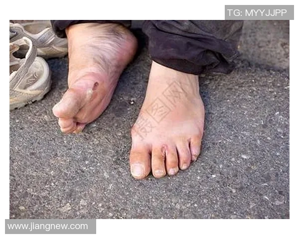 足球明星腿伤瞬间曝光背后的故事与恢复之路揭秘